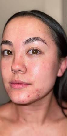 Laura Maidana - Antes