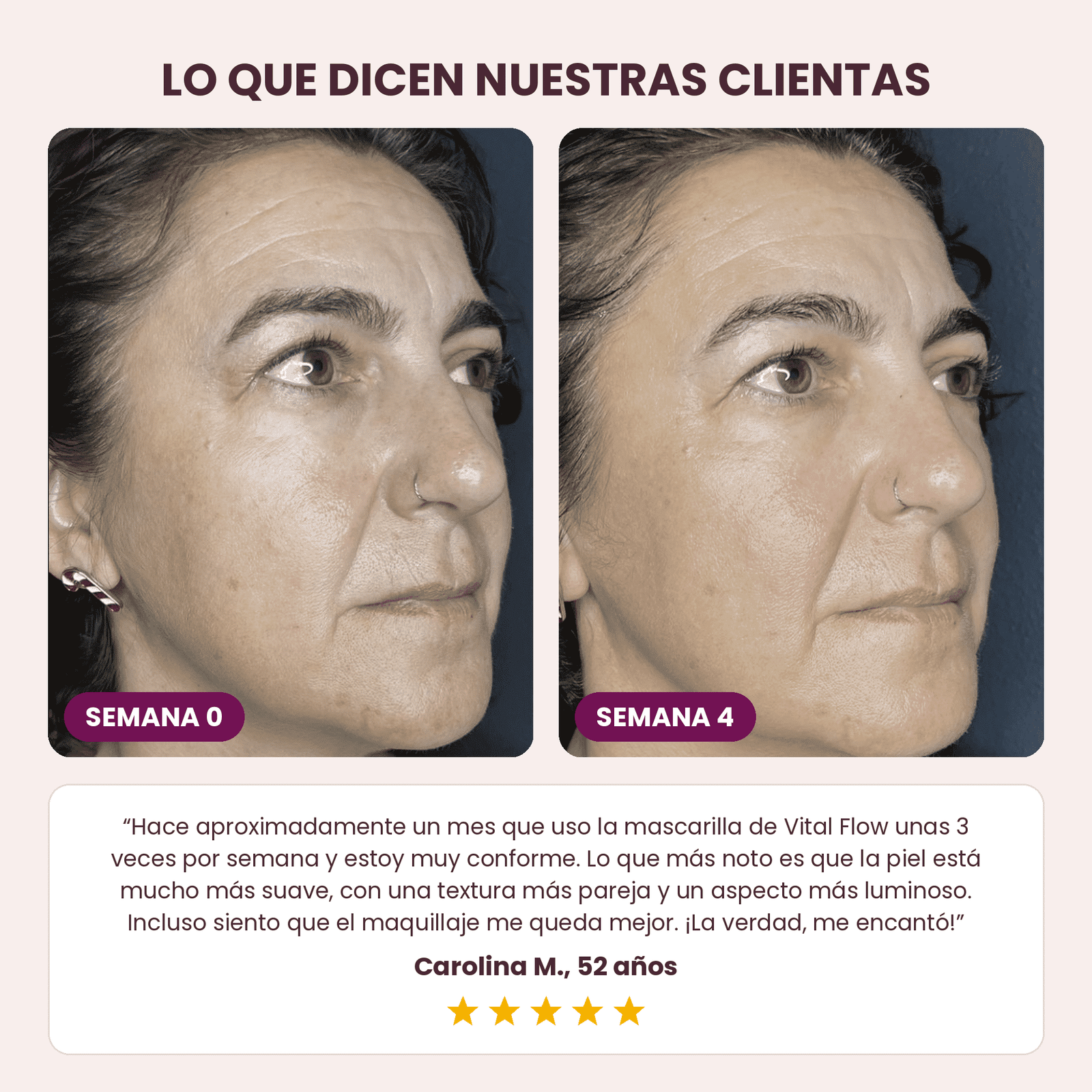 Vital Flow® Tratamiento Nocturno para Líneas de Expresión y Firmeza, sin Agujas