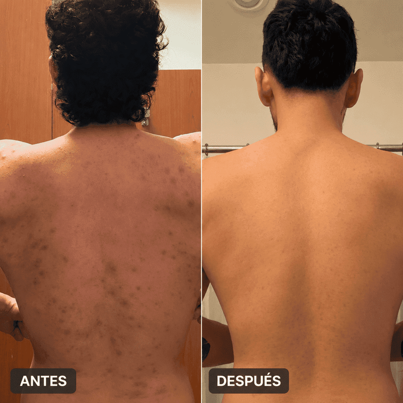 Antes y después 5