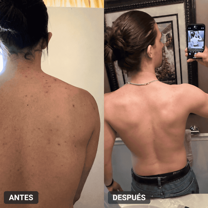 Antes y después 2