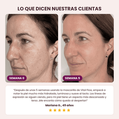 Vital Flow® Tratamiento Nocturno para Líneas de Expresión y Firmeza, sin Agujas