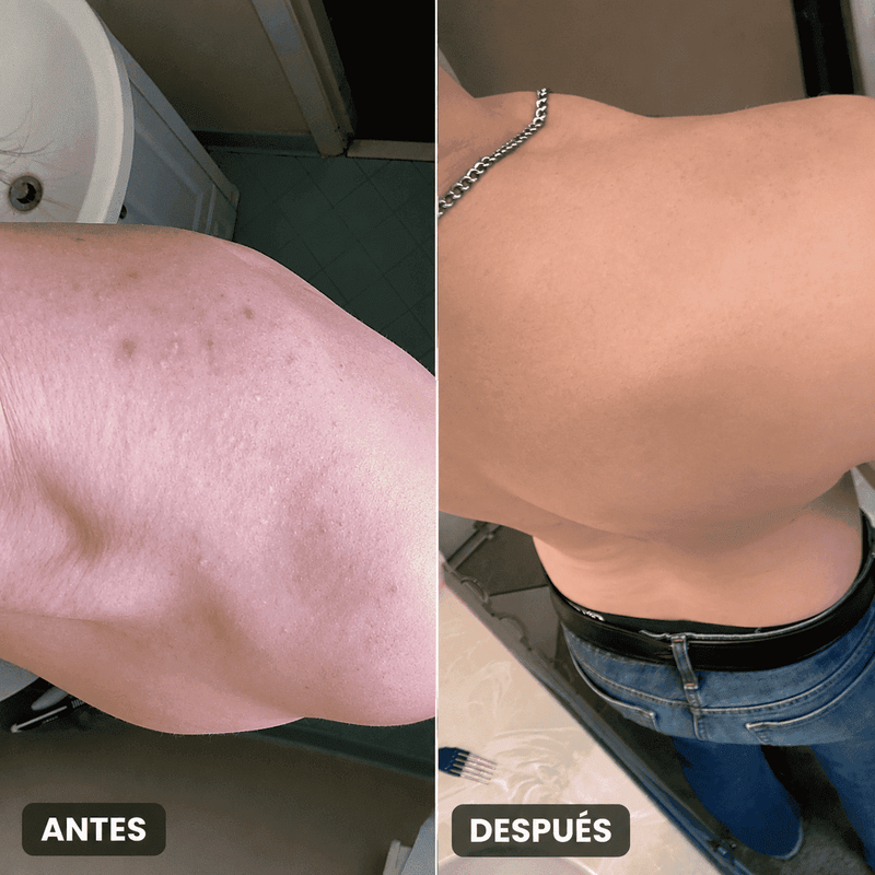 Antes y después 6